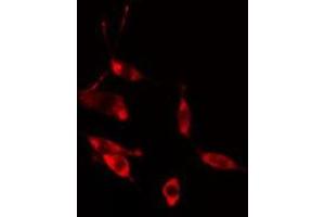 ABIN6275465 staining HeLa cells by IF/ICC. (RAB31 抗体  (Internal Region))