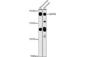 Western blot analysis of extracts of various cell lines, using VEGFR1 antibody (ABIN1683256, ABIN3015026, ABIN3015027 and ABIN6213602) at 1:1000 dilution. (FLT1 抗体  (AA 1100-1200))