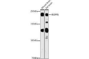 Western blot analysis of extracts of various cell lines, using VEGFR1 antibody (ABIN1683256, ABIN3015026, ABIN3015027 and ABIN6213602) at 1:1000 dilution. (FLT1 抗体  (AA 1100-1200))