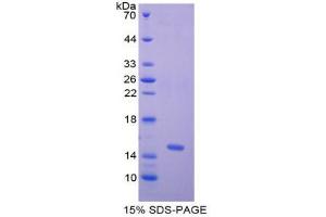 SDS-PAGE analysis of Human Nephrin Protein. (Nephrin 蛋白)