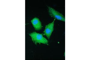 IF analysis of PARN using anti-PARN antibody (ABIN5693032). (PARN 抗体  (AA 1-301))