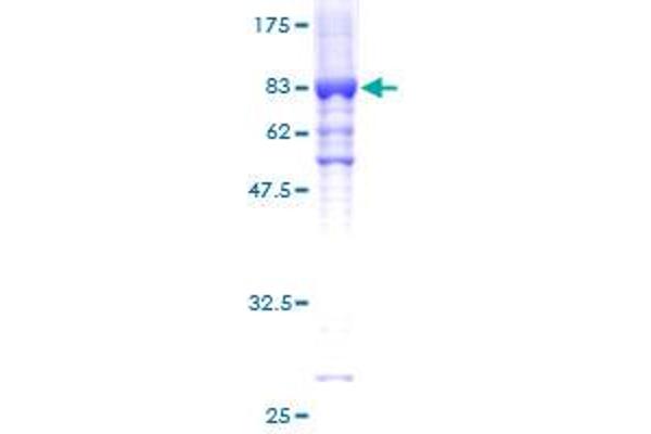 Glycerol Kinase Protein (GK) (AA 1-524) (GST tag)