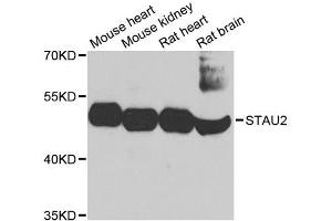 Western blot analysis of extracts of various cell lines, using STAU2 antibody. (Double-stranded RNA-binding protein Staufen homolog 2 (STAU2) (AA 300-400) 抗体)