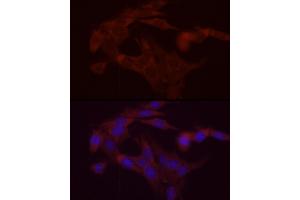 Immunofluorescence analysis of PC-12 cells using DG Rabbit pAb (ABIN6134325, ABIN6139556, ABIN6139557 and ABIN6222582) at dilution of 1:200 (40x lens). (DGAT1 抗体  (AA 200-300))