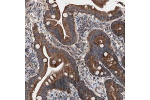 Immunohistochemical staining of human duodenum with CTTNBP2NL polyclonal antibody  shows strong cytoplasmic positivity in glandular cells. (CTTNBP2NL 抗体)