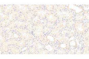 Detection of MCP1 in Human Kidney Tissue using Monoclonal Antibody to Monocyte Chemotactic Protein 1 (MCP1)