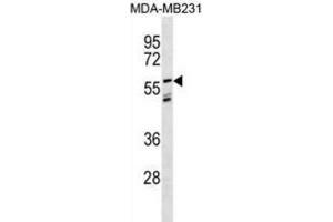 Western Blotting (WB) image for anti-Leucine-Rich Repeat LGI Family, Member 3 (LGI3) antibody (ABIN3000958) (LGI3 抗体)