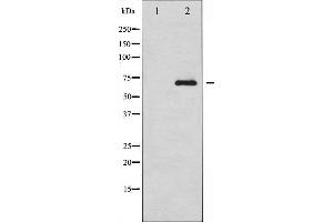 Western blot analysis of RelB expression in HepG2 whole cell lysates,The lane on the left is treated with the antigen-specific peptide.