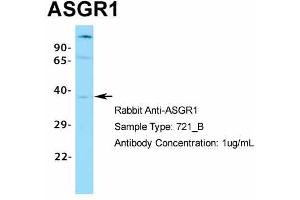 Western Blotting (WB) image for anti-Asialoglycoprotein Receptor 1 (ASGR1) (Middle Region) antibody (ABIN2778131)