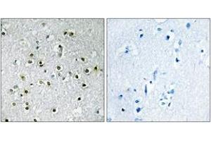 Immunohistochemistry analysis of paraffin-embedded human brain tissue, using TFE3 Antibody. (TFE3 抗体  (AA 101-150))
