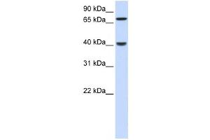 Western Blotting (WB) image for anti-PDZ and LIM Domain 3 (PDLIM3) antibody (ABIN2459845) (PDLIM3 抗体)
