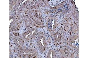 IHC analysis of MCM4 using anti-MCM4 antibody (ABIN7601485). (MCM4 抗体  (AA 361-677))