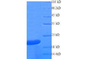 Tumor Necrosis Factor (TNF) (AA 77-233) protein (His tag)