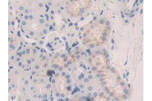 Used in DAB staining on fromalin fixed paraffin- embedded kidney tissue (CTSA 抗体  (AA 215-470))