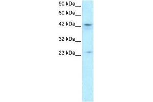 ZNF365 antibody used at 1. (ZNF365 抗体  (N-Term))