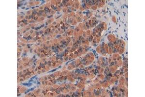 Immunohistochemistry (IHC) image for anti-Activating Transcription Factor 4 (Tax-Responsive Enhancer Element B67) (ATF4) (AA 125-329) antibody (ABIN1858092)