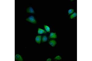 Immunofluorescence staining of Hela cells with ABIN7155168 at 1:66, counter-stained with DAPI. (PDE8B 抗体  (AA 18-110))