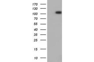 HEK293T cells were transfected with the pCMV6-ENTRY control (Left lane) or pCMV6-ENTRY PRKD2 (Right lane) cDNA for 48 hrs and lysed. (PKD2 抗体)