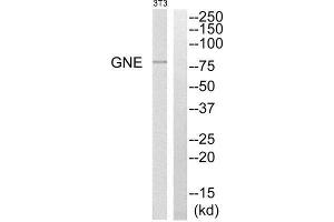 Western Blotting (WB) image for anti-Glucosamine (UDP-N-Acetyl)-2-Epimerase/N-Acetylmannosamine Kinase (GNE) (C-Term) antibody (ABIN1852526) (GNE 抗体  (C-Term))