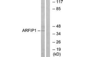 Western blot analysis of extracts from Jurkat cells, using ARFIP1 Antibody. (ARFIP1 抗体  (AA 271-320))