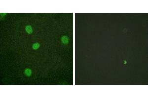 P-peptide - +Western blot analysis of extracts from K562 cells, using B-Myb (Phospho-Ser577/581) antibody. (MYBL2 抗体  (pSer577, pSer581))
