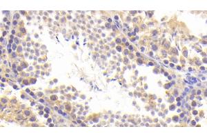 Immunohistochemistry (IHC) image for anti-beta-Site APP-Cleaving Enzyme 2 (BACE2) (AA 242-502) antibody (ABIN7438730)