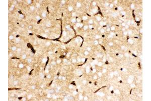 Anti- SLC2A1 Picoband antibody, IHC(P) IHC(P): Mouse Brain Tissue (GLUT1 抗体  (AA 92-492))