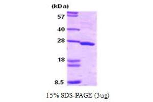 SDS-PAGE (SDS) image for Synaptosomal-Associated Protein, 25kDa (SNAP25) (AA 1-206) protein (ABIN667078) (SNAP25 Protein (AA 1-206))