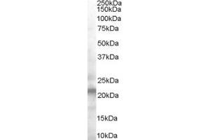 ABIN185544 (0. (VPS25 抗体  (Internal Region))