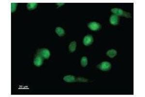 Immunostaining analysis in HeLa cells. (LMO1 抗体)