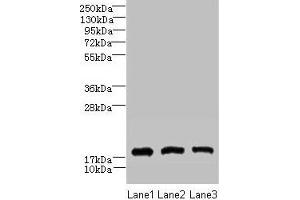 Western blot All lanes: CNIH2 antibody at 2 μg/mL Lane 1: U251 whole cell lysate Lane 2: Mouse liver tissue Lane 3: Mouse kidney tissue Secondary Goat polyclonal to rabbit IgG at 1/10000 dilution Predicted band size: 19 kDa Observed band size: 19 kDa (CNIH2 抗体  (AA 94-138))