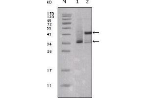 Western blot analysis using ESR1 mouse mAb against truncated ESR1-His recombinant protein (1) and truncated Trx-ESR1 recombinant protein (2).