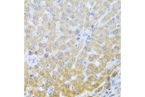 Immunohistochemistry of paraffin-embedded human liver using IL20 antibody at dilution of 1:100 (40x lens). (IL-20 抗体)