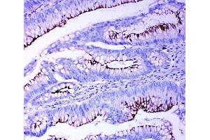 Immunohistochemistry (IHC) image for anti-Profilin 2 (PFN2) (C-Term) antibody (ABIN3032305)