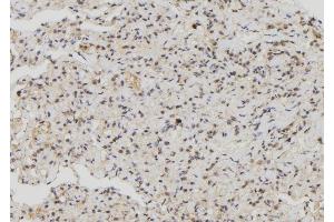 ABIN6276875 at 1/100 staining Human lung tissue by IHC-P. (MX1 抗体  (C-Term))