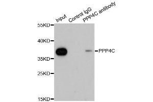 Immunoprecipitation analysis of 200ug extracts of 293T cells using 1ug PPP4C antibody. (PPP4C 抗体  (AA 1-307))