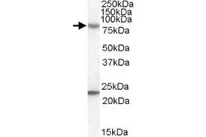 DHX58 polyclonal antibody  (0. (DHX58 抗体)