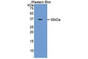 Detection of Recombinant HSD17b1, Human using Polyclonal Antibody to 17-Beta-Hydroxysteroid Dehydrogenase Type 1 (HSD17b1) (HSD17B1 抗体  (AA 4-289))