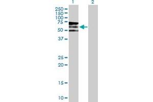 Western Blot analysis of PIP5K3 expression in transfected 293T cell line by PIP5K3 MaxPab polyclonal antibody. (PIKFYVE 抗体  (AA 1-451))