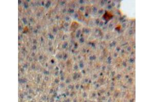 Used in DAB staining on fromalin fixed paraffin-embedded Liver tissue (Syndecan 1 抗体  (AA 23-255))