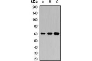 Western blot analysis of Karyopherin alpha-6 expression in BT474 (A), SW620 (B), mouse testis (C) whole cell lysates. (KPNA6 抗体)