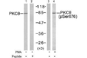 Image no. 2 for anti-Protein Kinase C, theta (PRKCQ) (pSer676) antibody (ABIN197071) (PKC theta 抗体  (pSer676))