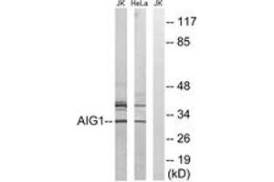 Western blot analysis of extracts from HeLa/Jurkat cells, using AIG1 Antibody.