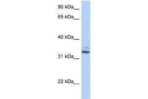 WB Suggested Anti-SULT1A1 Antibody Titration:  0. (SULT1A1 抗体  (N-Term))