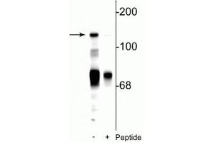 Western blot of rat cerebellar lysate showing specific immunolabeling of the ~140 kDa NR2C subunit of the NMDA receptor phosphorylated at Ser1244 in the first lane (-). (GRIN2C 抗体  (pSer1244))