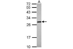 WB Image Sample (30 ug of whole cell lysate) A:IMR32 12% SDS PAGE antibody diluted at 1:1000 (PRNP 抗体)