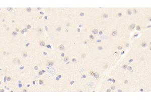 Immunohistochemistry (IHC) image for anti-Peroxiredoxin 6 (PRDX6) (AA 1-224) antibody (ABIN7436129)