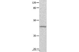 Western blot analysis of Mouse eyes tissue, using GNA11 Polyclonal Antibody at dilution of 1:550 (GNA11 抗体)