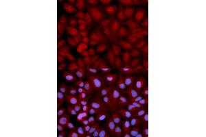 Immunofluorescence analysis of U2OS cell using SNCG antibody. (SNCG 抗体  (AA 1-127))
