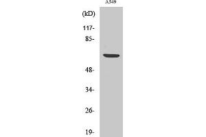 Western Blotting (WB) image for anti-Ribosomal Protein S6 Kinase, 70kDa, Polypeptide 1 (RPS6KB1) (pSer447) antibody (ABIN5957328) (RPS6KB1 抗体  (pSer447))